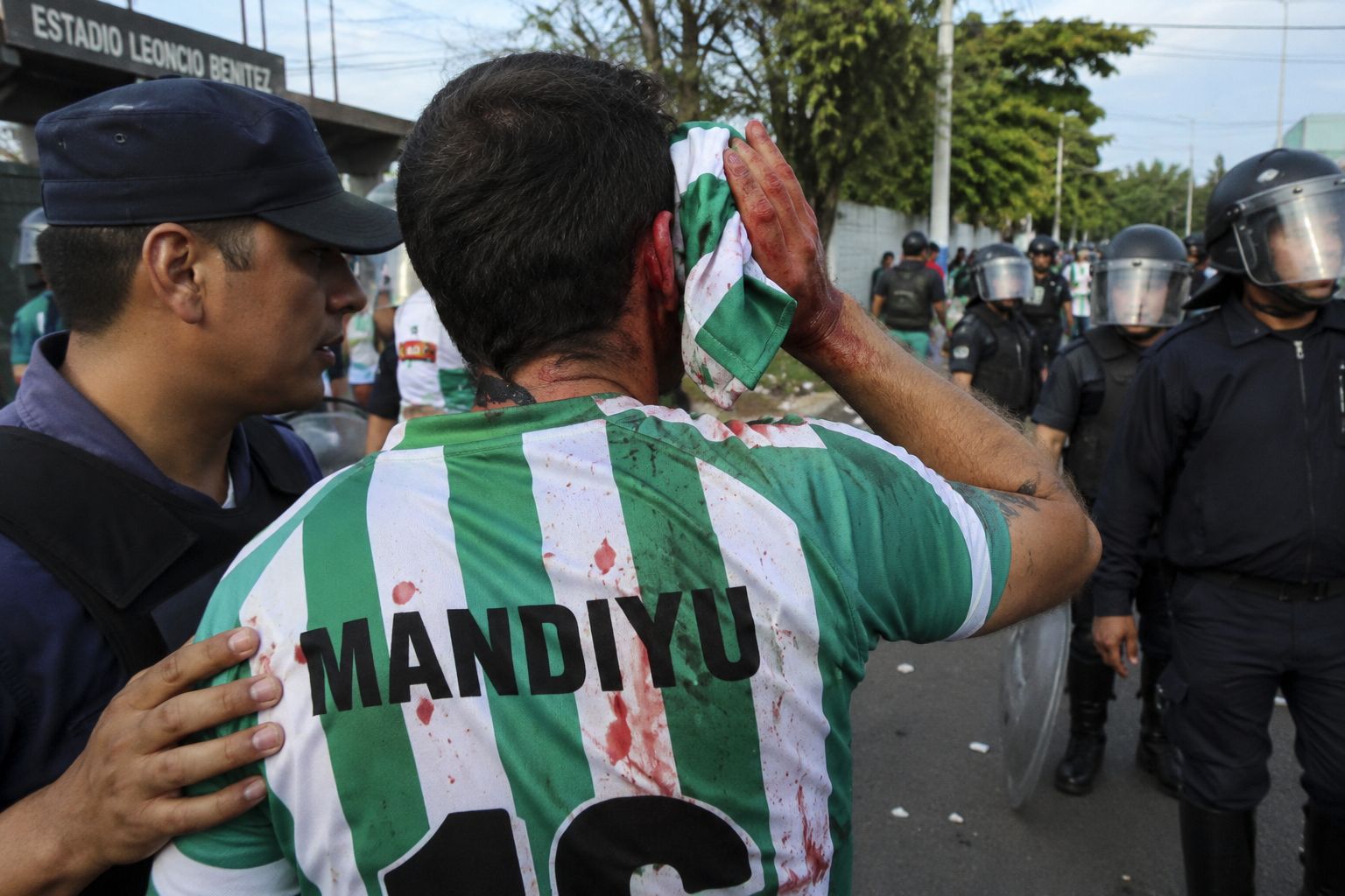 Ratifican indemnización para un hincha de Mandiyú que perdió un ojo tras recibir un disparo en un operativo policial